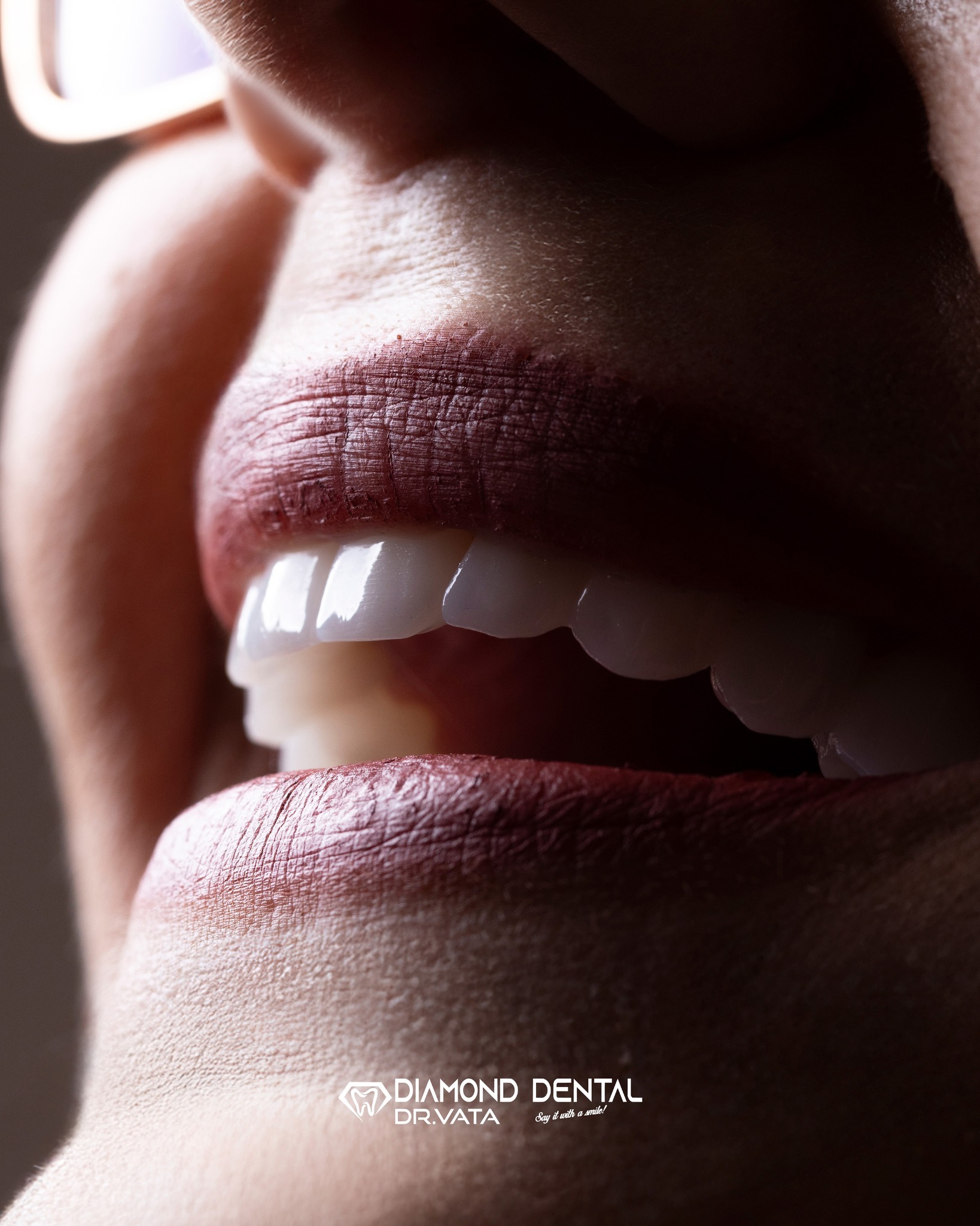 Implante Dentare