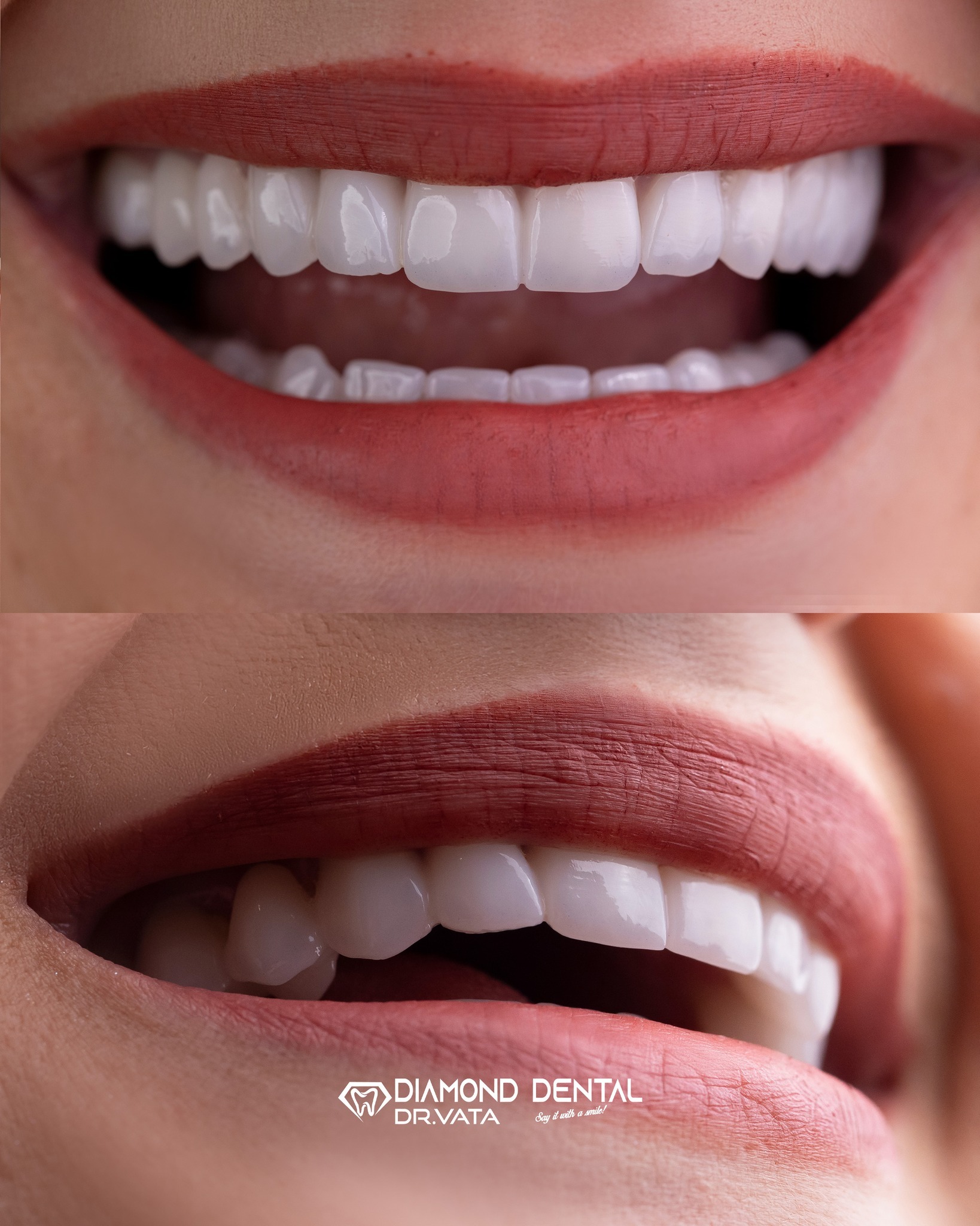 Kurora Dentare